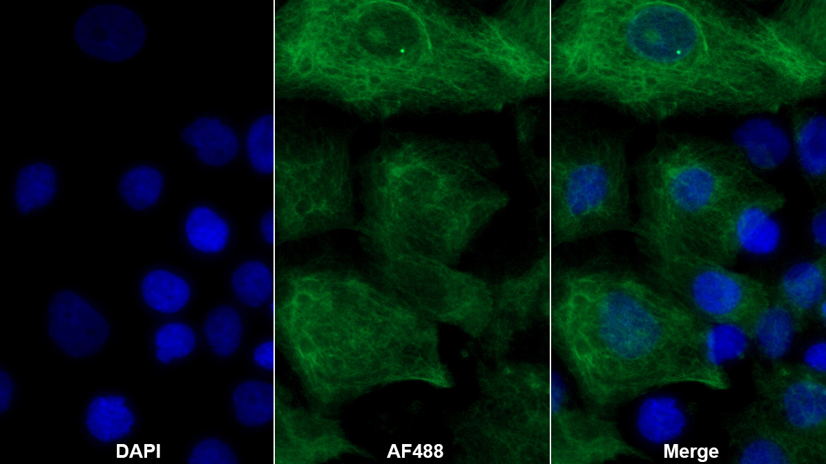 Polyclonal Antibody to Cytokeratin 14 (CK14)
