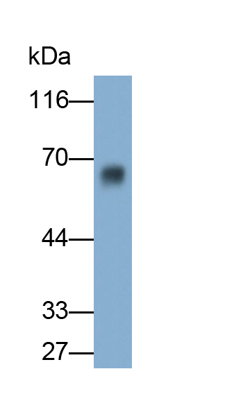 Polyclonal Antibody to Tissue Plasminogen Activator (tPA)
