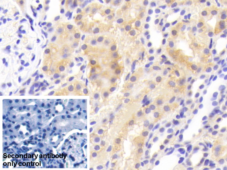 Polyclonal Antibody to Leucine Aminopeptidase (LAP)