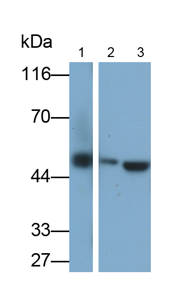 Polyclonal Antibody to Enolase, Neuron Specific (NSE)