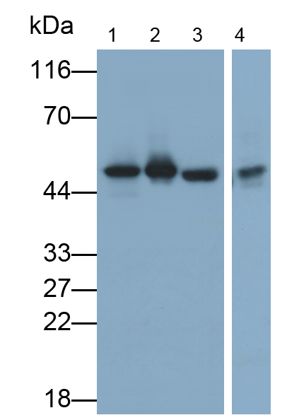 Polyclonal Antibody to Enolase, Neuron Specific (NSE)