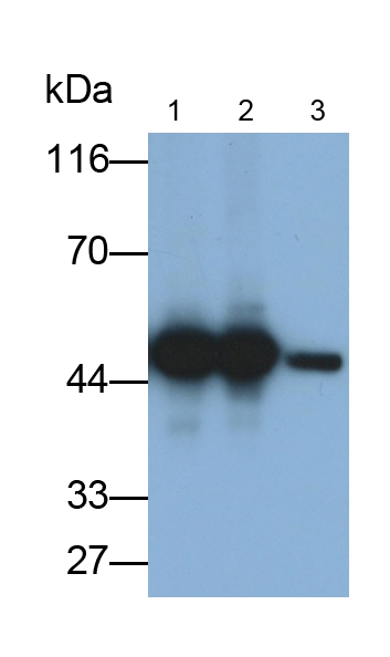 Polyclonal Antibody to Enolase, Neuron Specific (NSE)