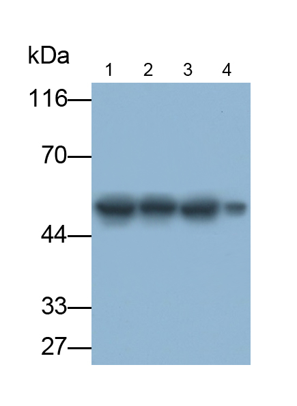 Polyclonal Antibody to Enolase, Neuron Specific (NSE)