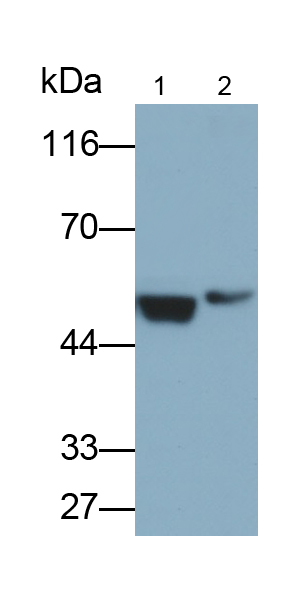 Polyclonal Antibody to Enolase, Neuron Specific (NSE)