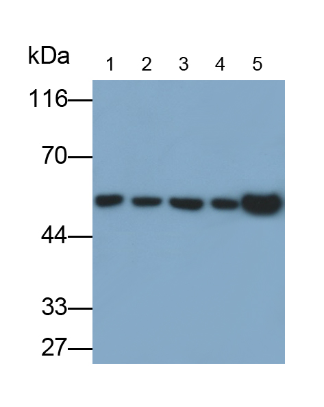 Polyclonal Antibody to Enolase, Neuron Specific (NSE)
