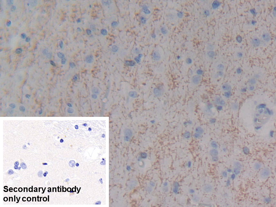 Polyclonal Antibody to Myelin Basic Protein (MBP)