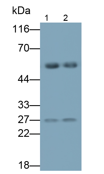 Polyclonal Antibody to Immunoglobulin M (IgM)