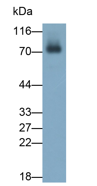 Polyclonal Antibody to Immunoglobulin M (IgM)