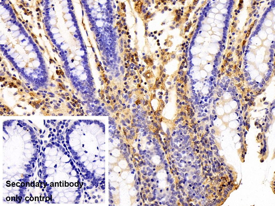 Polyclonal Antibody to Immunoglobulin M (IgM)