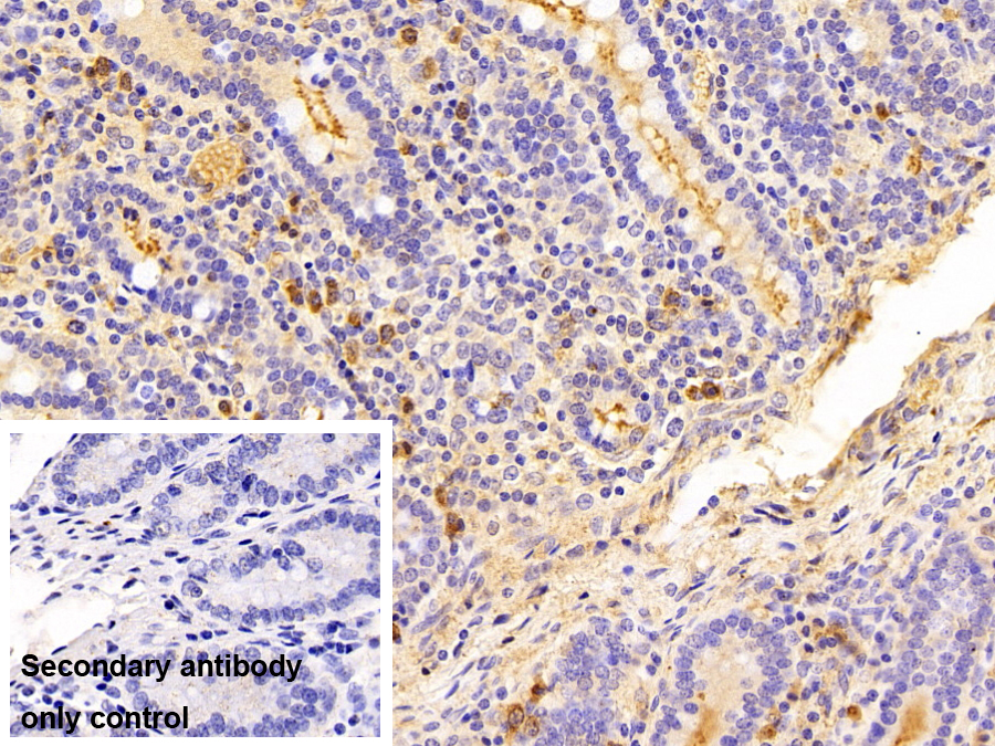 Polyclonal Antibody to Immunoglobulin M (IgM)