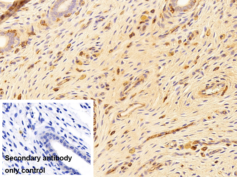 Polyclonal Antibody to Immunoglobulin M (IgM)