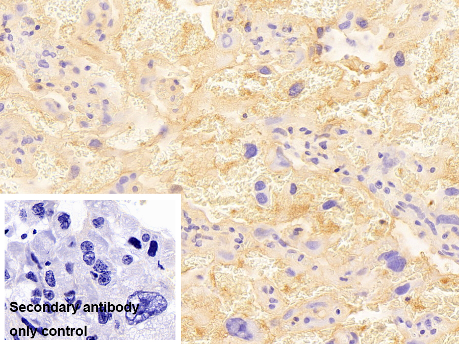 Polyclonal Antibody to Immunoglobulin M (IgM)