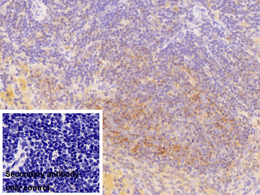 Polyclonal Antibody to Immunoglobulin M (IgM)