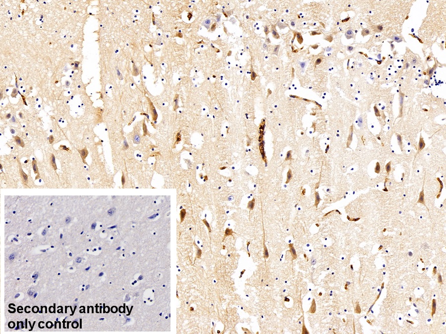 Polyclonal Antibody to Immunoglobulin G (IgG)