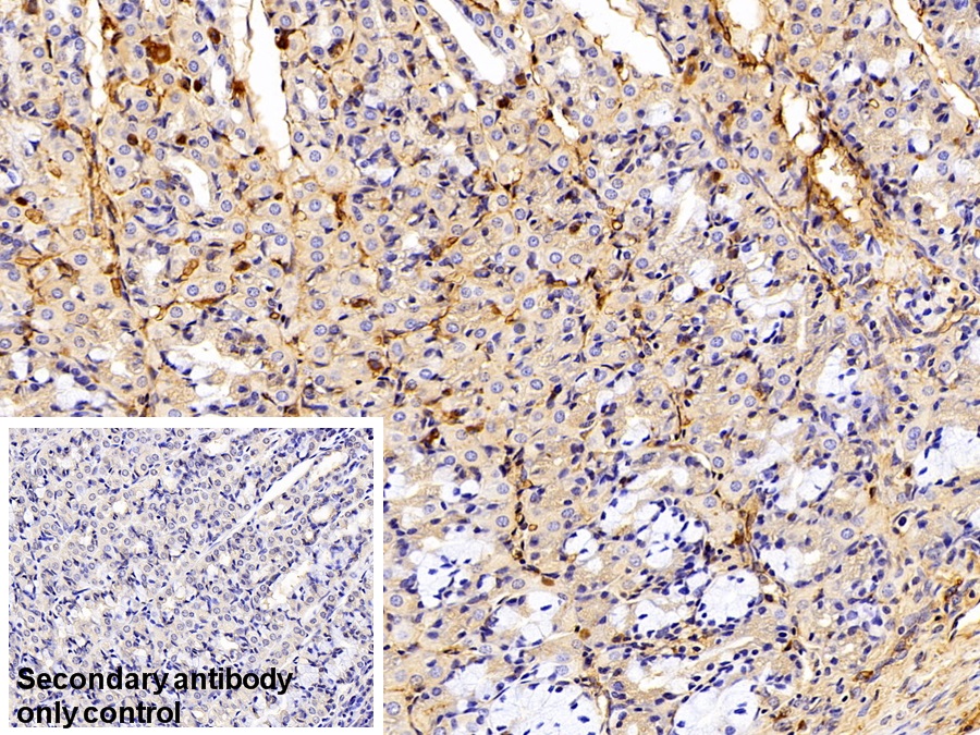 Polyclonal Antibody to Immunoglobulin G (IgG)