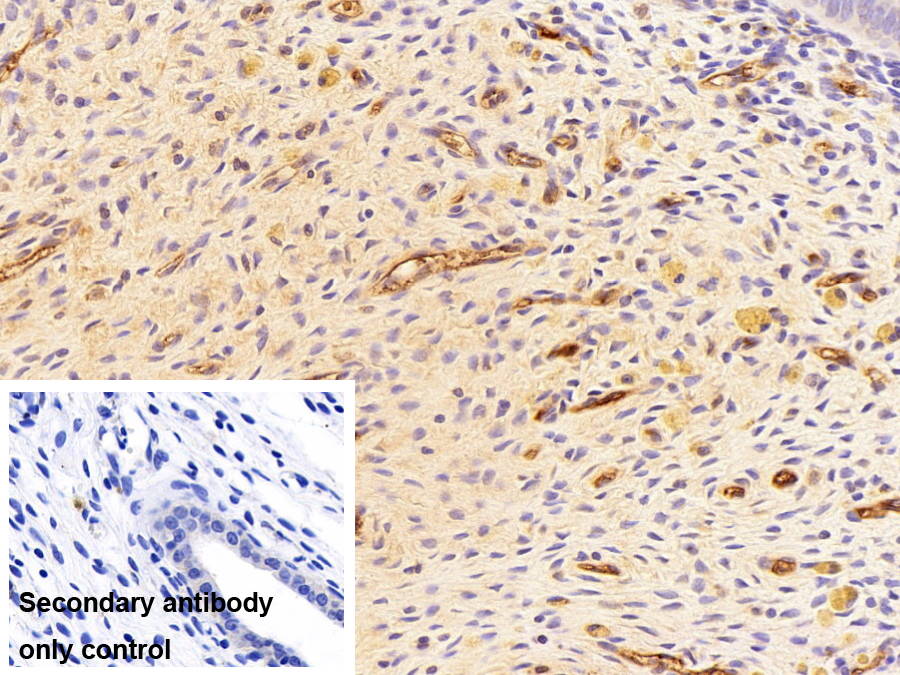 Polyclonal Antibody to Immunoglobulin E (IgE)