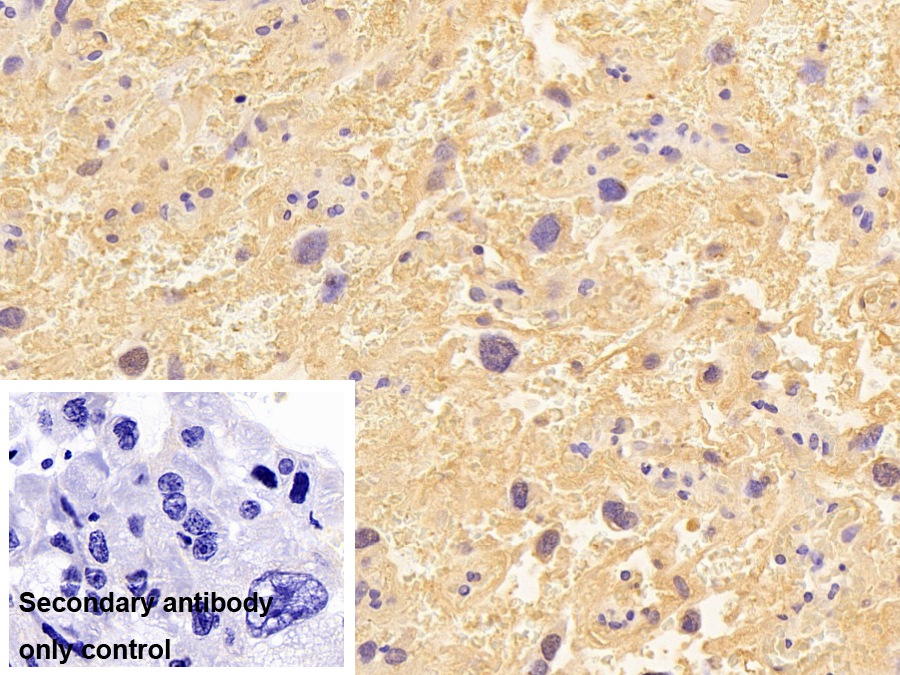 Polyclonal Antibody to Immunoglobulin E (IgE)