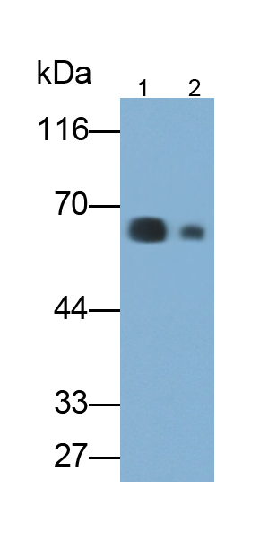Polyclonal Antibody to Immunoglobulin A (IgA)