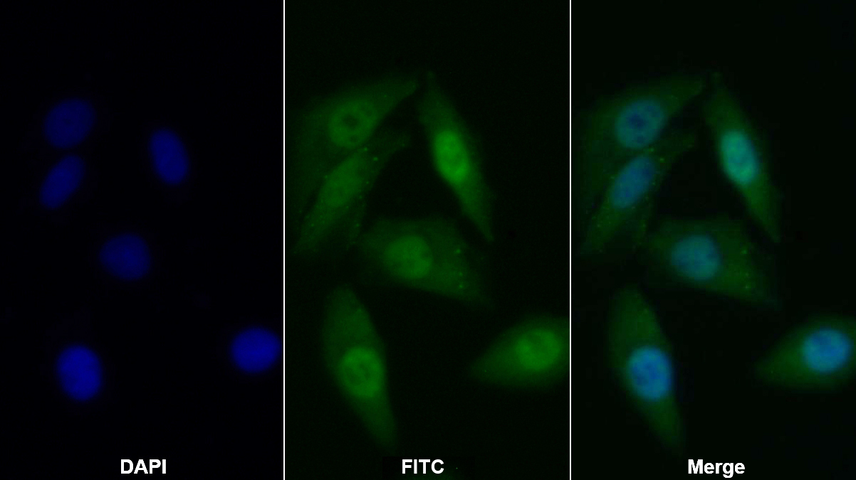 Polyclonal Antibody to Fibroblast Growth Factor 2, Basic (FGF2)