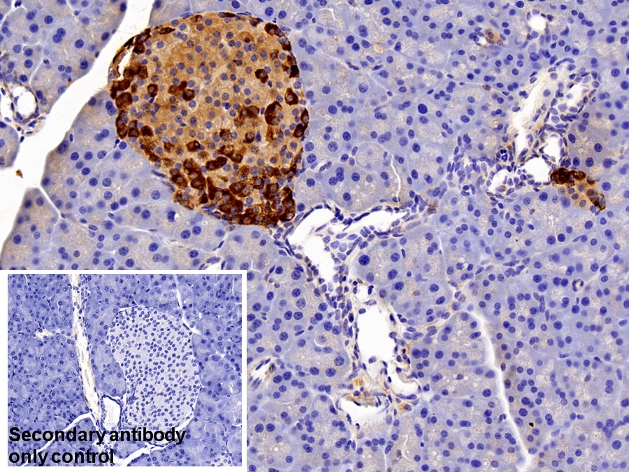 Polyclonal Antibody to Tissue Inhibitors Of Metalloproteinase 1 (TIMP1)