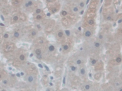 Polyclonal Antibody to Nicotinamide Adenine Dinucleotide Phosphate Oxidase 5 (NOX5)
