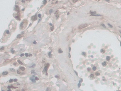 Polyclonal Antibody to Nicotinamide Adenine Dinucleotide Phosphate Oxidase 5 (NOX5)