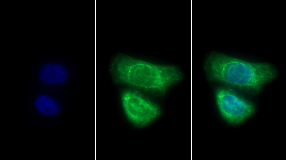 Polyclonal Antibody to Cytokeratin 7 (CK7)