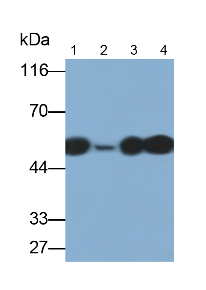 Polyclonal Antibody to Cytokeratin 7 (CK7)