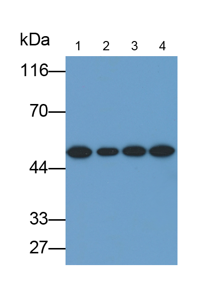 Polyclonal Antibody to Cytokeratin 7 (CK7)