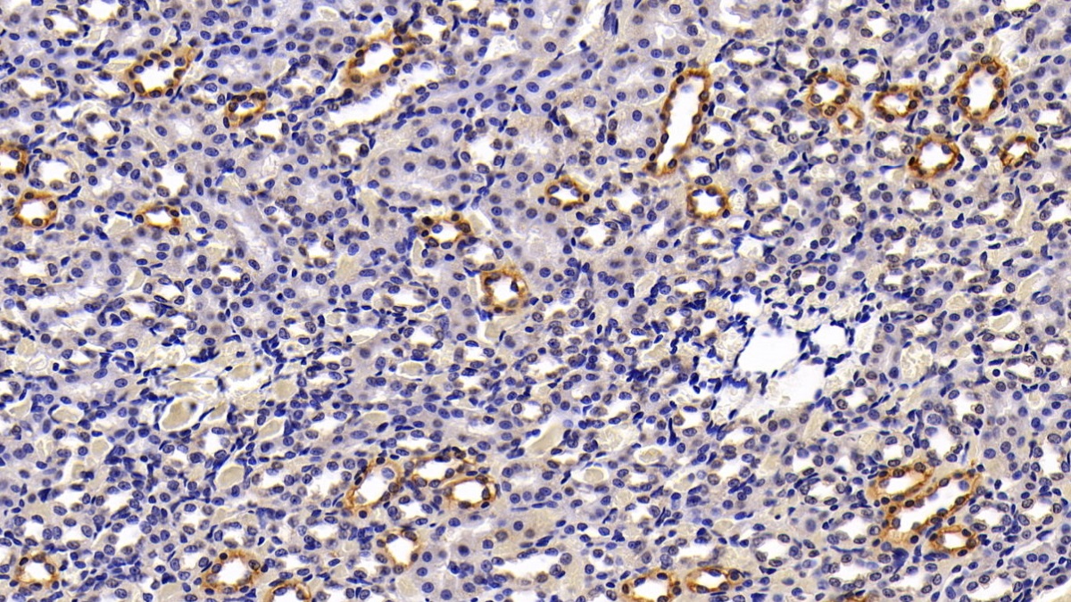 Polyclonal Antibody to Cytokeratin 7 (CK7)