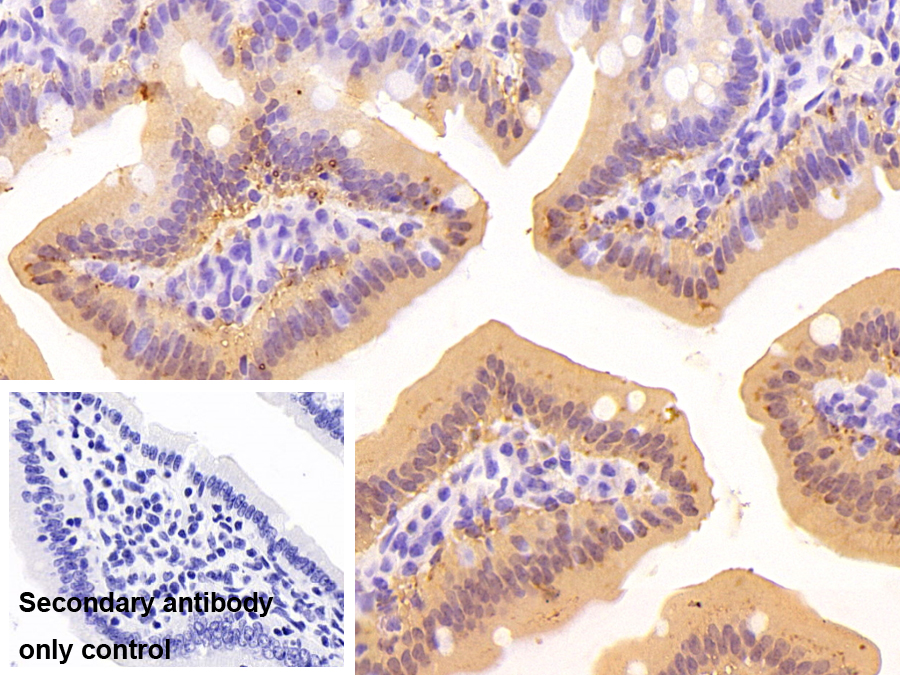 Polyclonal Antibody to Fatty Acid Binding Protein 2, Intestinal (FABP2)