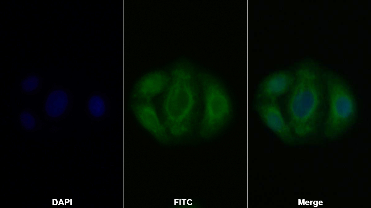 Polyclonal Antibody to Leukemia Inhibitory Factor Receptor (LIFR)