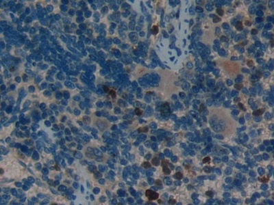 Polyclonal Antibody to Leukemia Inhibitory Factor Receptor (LIFR)