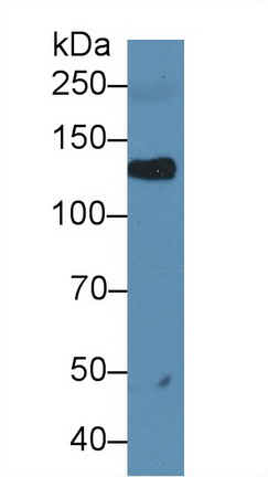 Polyclonal Antibody to Leukemia Inhibitory Factor Receptor (LIFR)