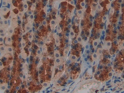 Polyclonal Antibody to Leukemia Inhibitory Factor Receptor (LIFR)