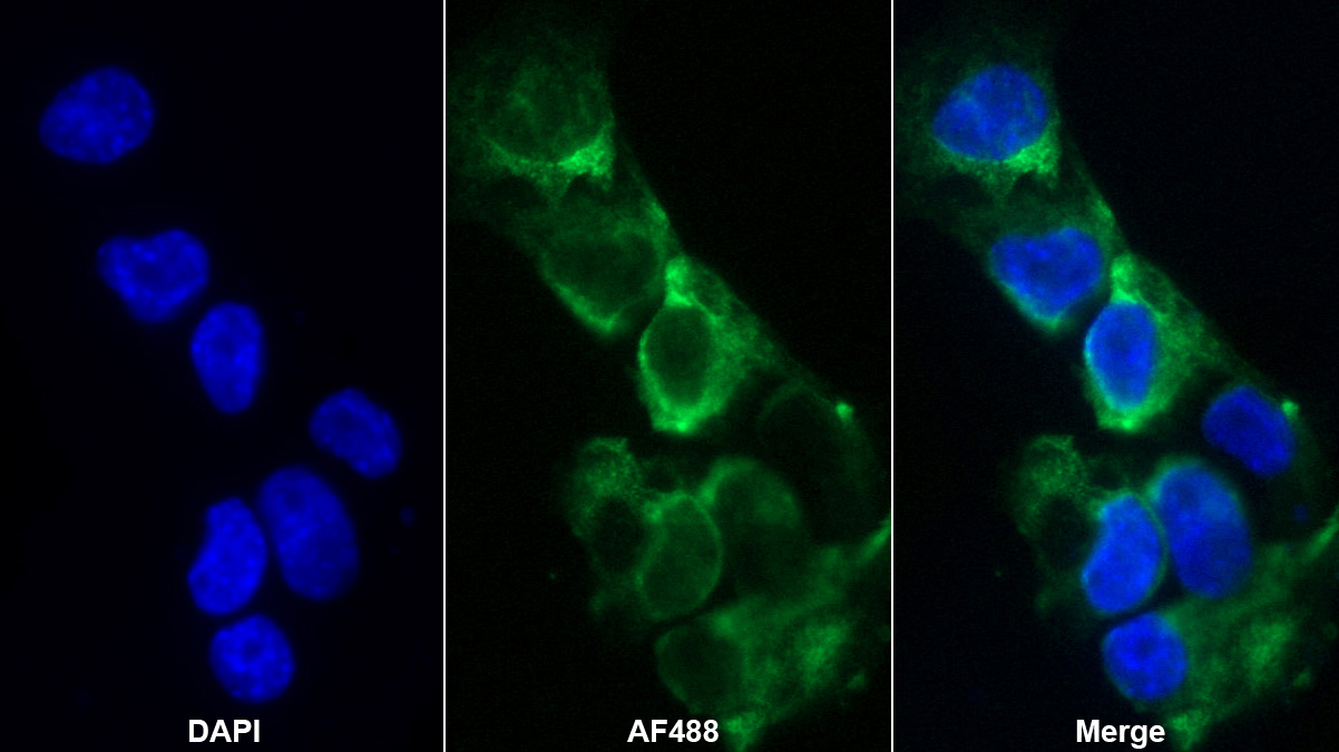 Polyclonal Antibody to Leukemia Inhibitory Factor Receptor (LIFR)