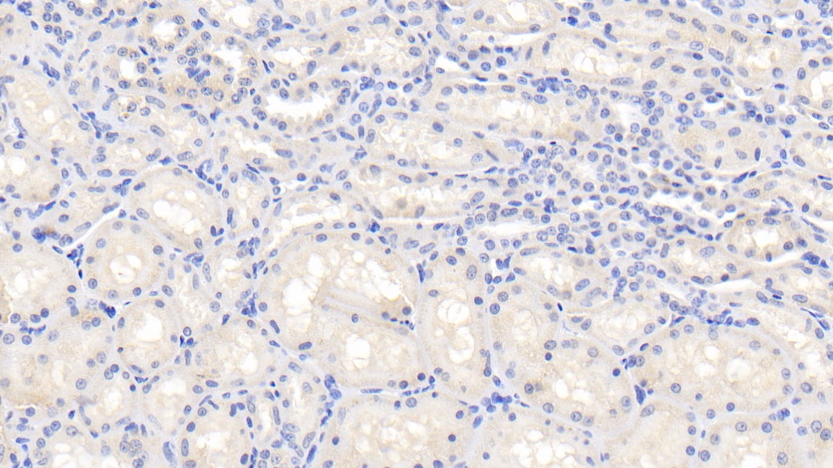 Polyclonal Antibody to Interleukin 1 Beta (IL1b)