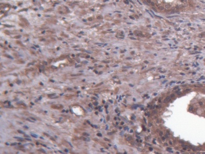 Polyclonal Antibody to Heparan Sulfate Proteoglycan (HSPG)