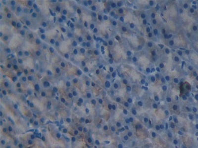 Polyclonal Antibody to Interleukin 1 Delta (FIL1d)