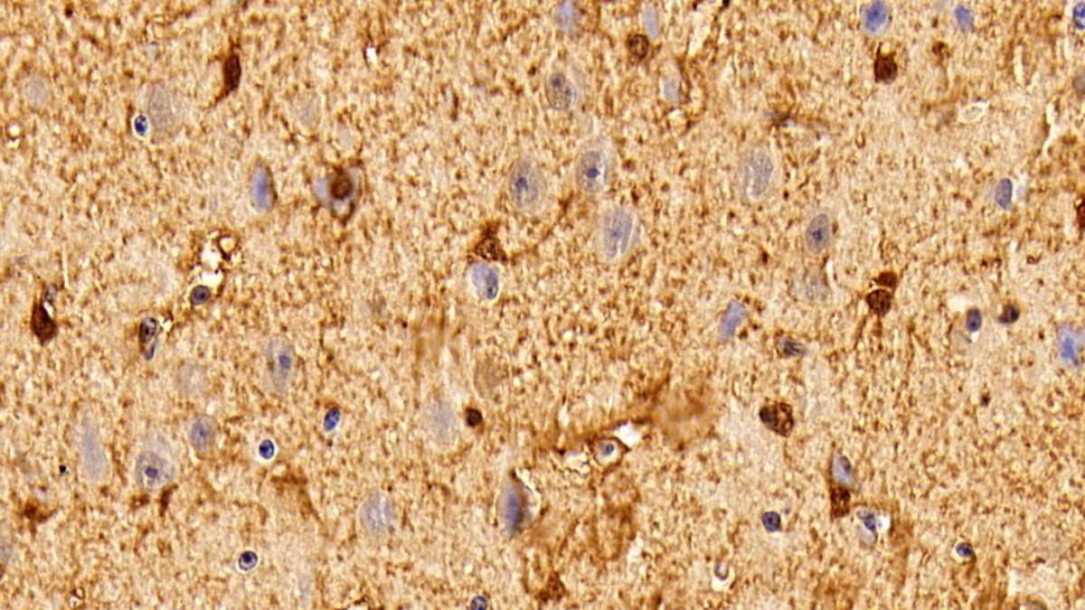 Polyclonal Antibody to S100 Calcium Binding Protein B (S100B)