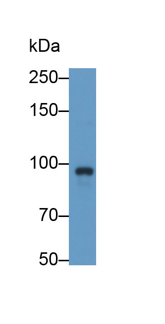 Polyclonal Antibody to P-Selectin (SELP)