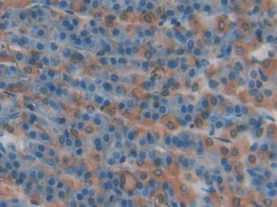 Polyclonal Antibody to P-Selectin (SELP)