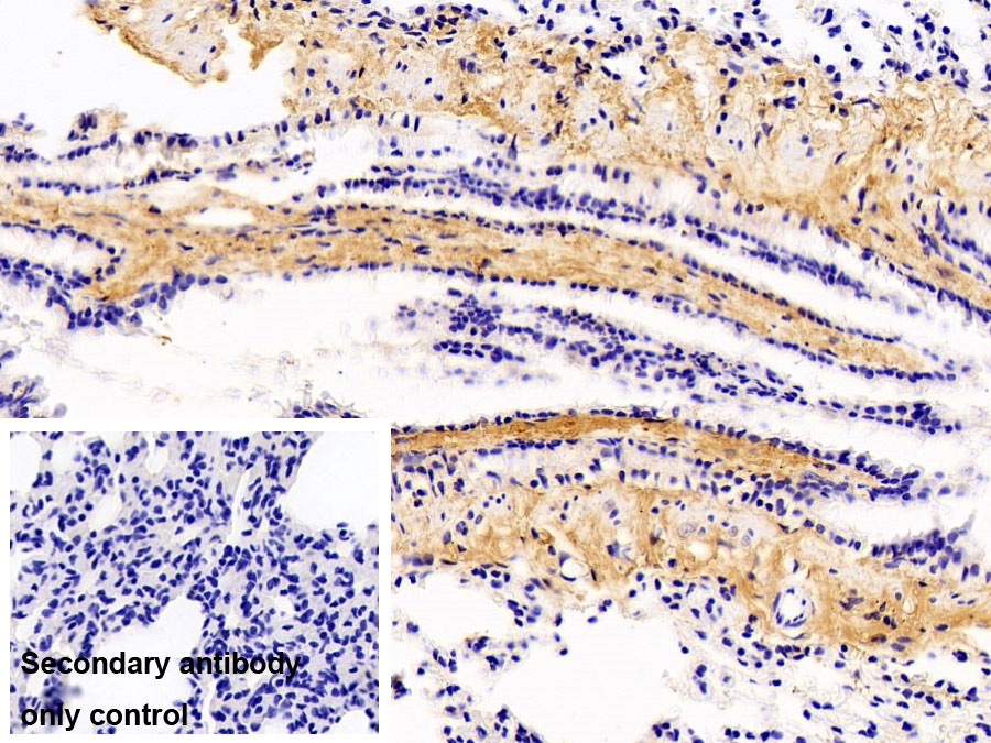Polyclonal Antibody to Collagen Type I (COL1)