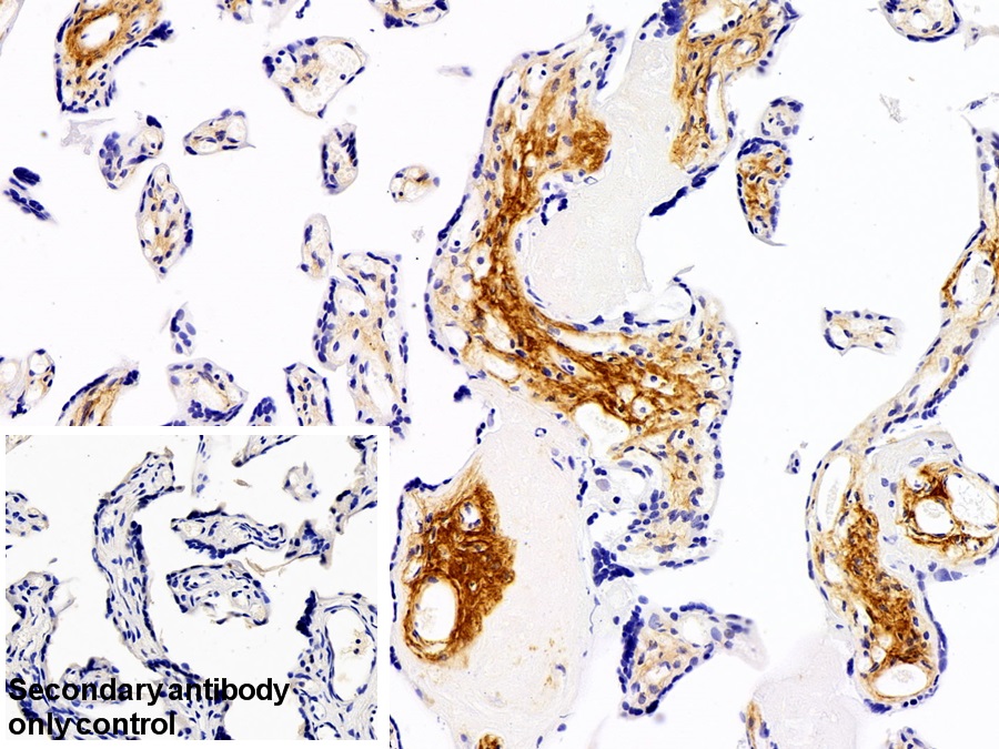 Polyclonal Antibody to Procollagen III N-Terminal Propeptide (PIIINP)