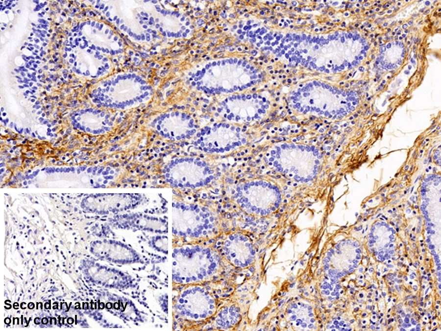 Polyclonal Antibody to Procollagen III N-Terminal Propeptide (PIIINP)