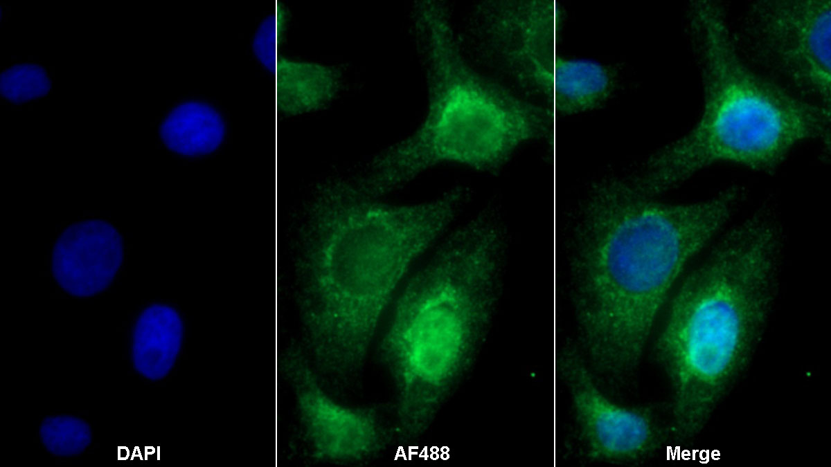 Polyclonal Antibody to Procollagen III N-Terminal Propeptide (PIIINP)