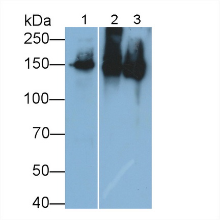 Polyclonal Antibody to Procollagen III N-Terminal Propeptide (PIIINP)