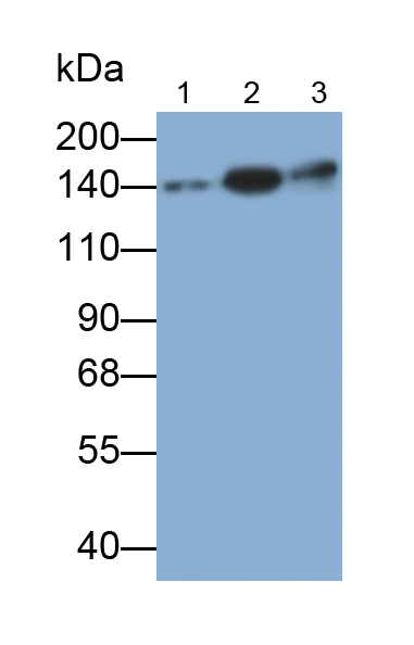 Polyclonal Antibody to Procollagen III N-Terminal Propeptide (PIIINP)