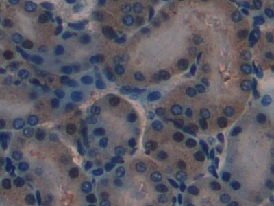 Polyclonal Antibody to Laminin Alpha 1 (LAMA1)