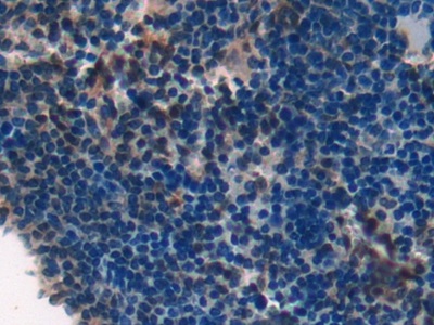 Polyclonal Antibody to Laminin Alpha 1 (LAMA1)